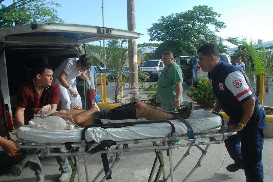 Buseta colisiona con árbol y deja 4 heridos en Puntarenas - Diario Extra Costa Rica