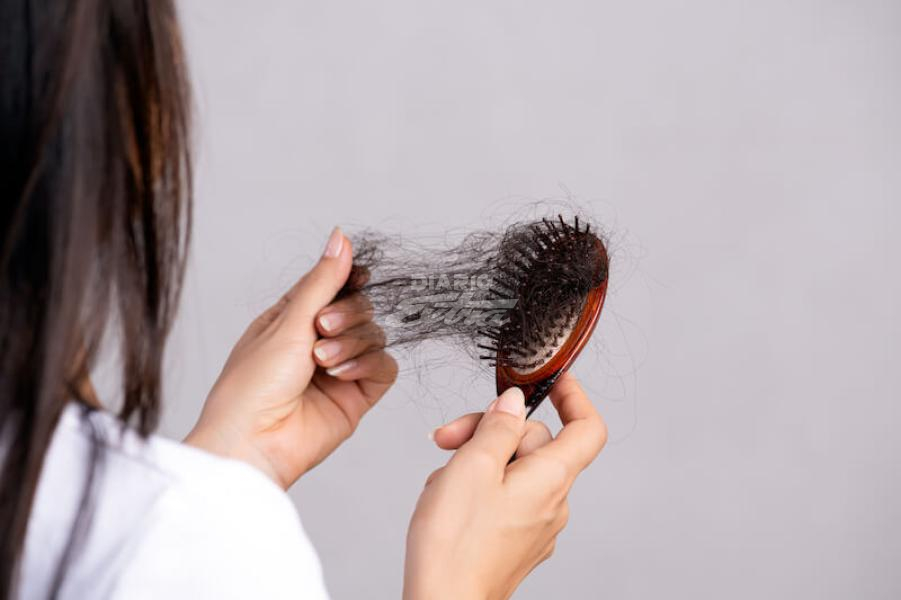 Diario - Remedios naturales contra la caída del cabello